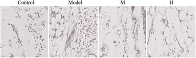 Therapeutic effect of Periploca forrestii on collagen-induced arthritis in rats through JAK2/Nf-κB pathway